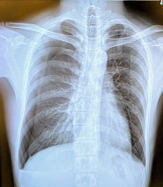 レビュー投稿の拡大画像